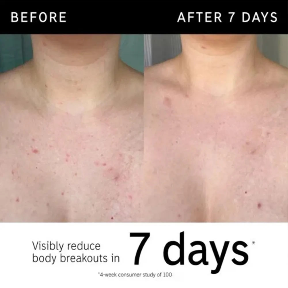Glycolic Acid Exfoliating Body Stick